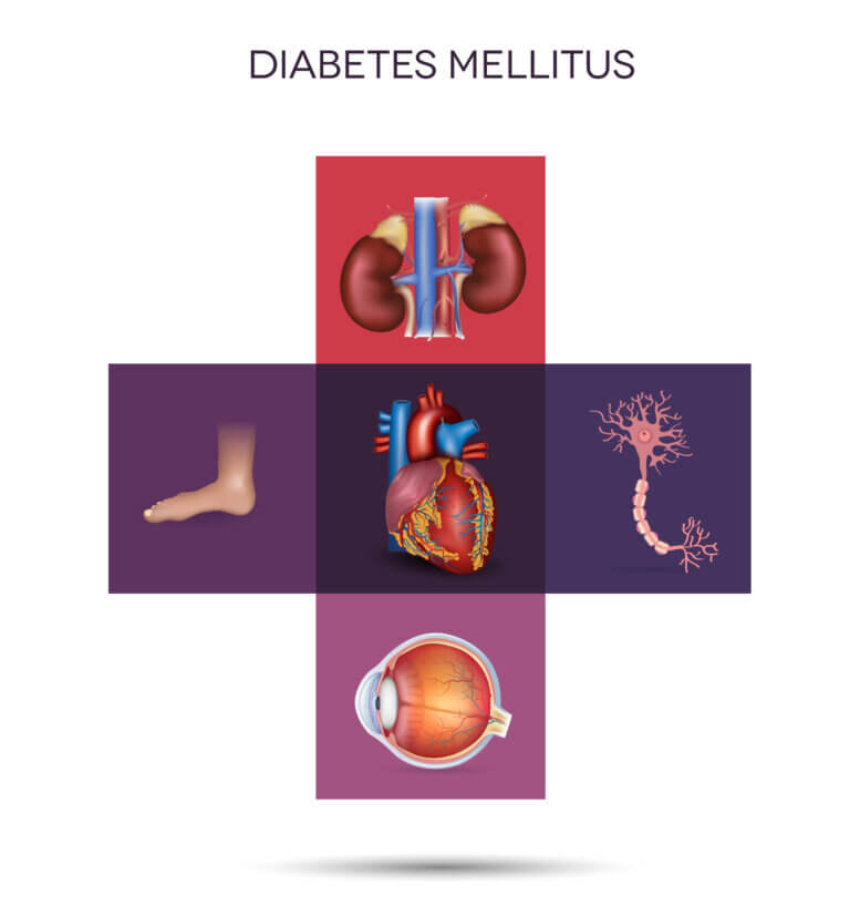 The damage of diabetes. Image: depositphotos.com