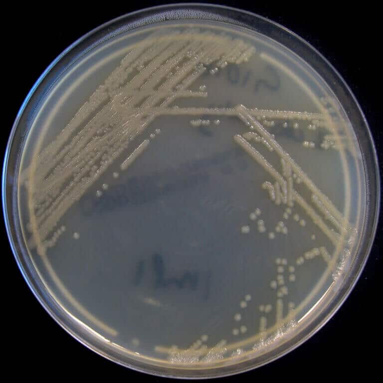 Pseudomonas aeruginosa הוא חיידק נפוץ מאוד בישראל ובעולם, שמצוי בקרקע, במים, בצמחים ולעיתים נדירות אף בריאות האנושיות. צילום: Nathan Reading, Flickr, CC BY-NC-ND 2.0