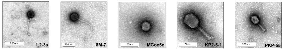 The Fantastic Five: The members of the phage cocktail against bacteria that cause inflammatory bowel disease, as seen under an electron microscope
