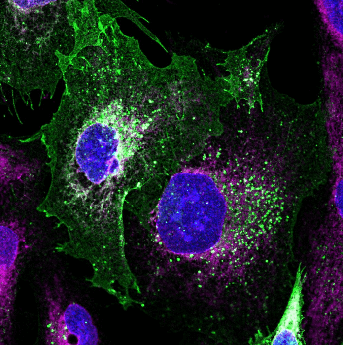 Image of patient-derived kidney podocyte cells modified using a novel vector-mediated approach by Berger's team. The podocin (in green) is returned to the front of the cell as in healthy podocytes. Courtesy of the researchers
