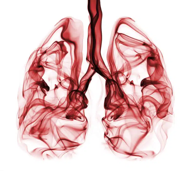 Smoking and cancer. Image: depositphotos.com