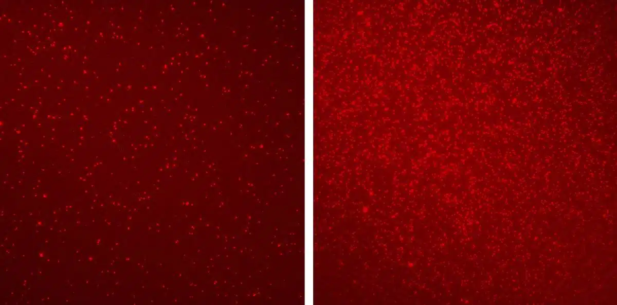 דפוסים אפיגנטיים שונים באנשים בריאים (משמאל) ובאנשים עם סרטן המעי (מימין), כפי שנחשפו באמצעות דגימות דם