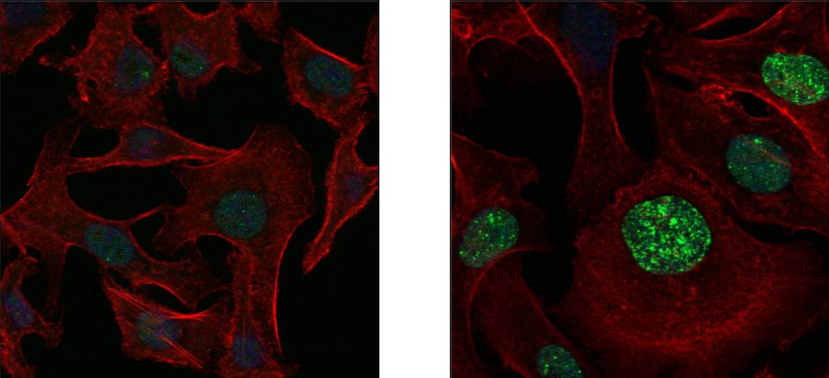 תאי סרטן ריאות תחת מיקרוסקופ, לפני (שמאל) ואחרי (ימין) טיפול בתרופה נוגדת-סרטן, הגורמת לשברים בדי-אן-אי (ירוק) בגרעיני התאים