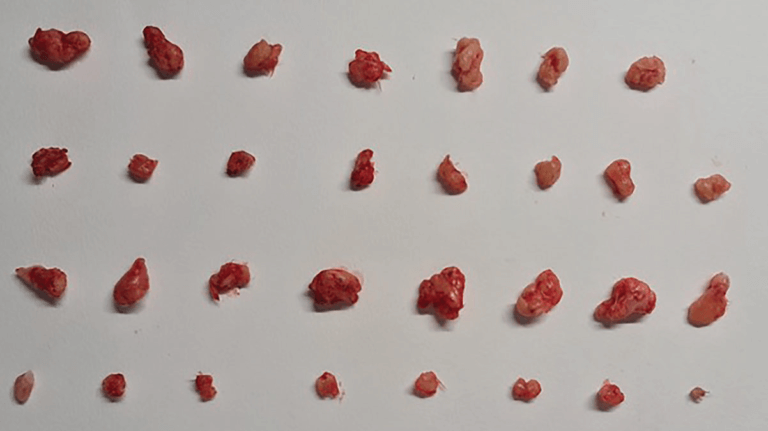 أورام الثدي التي عولجت بدواء السيسبلاتين (الصف الثاني والرابع) مقارنة بالأورام التي لم تعالج بهذه الطريقة (الصف العلوي والثالث)