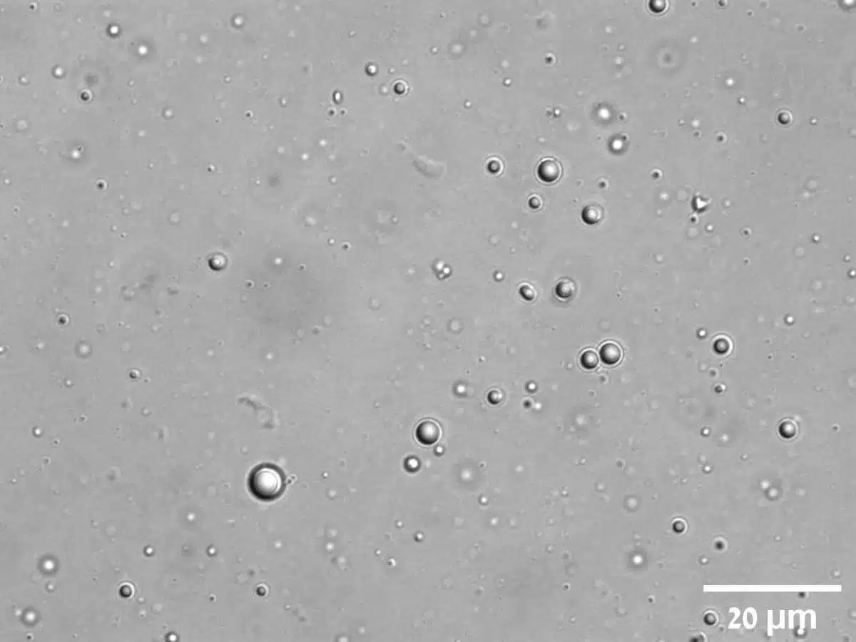 כמו טיפות שומן במרק עוף: תמונת מיקרוסקופ של הטיפות הזעירות שנוצרו בתמיסה בעקבות חיבור בין פפטידים למולקולות אר-אן-אי
