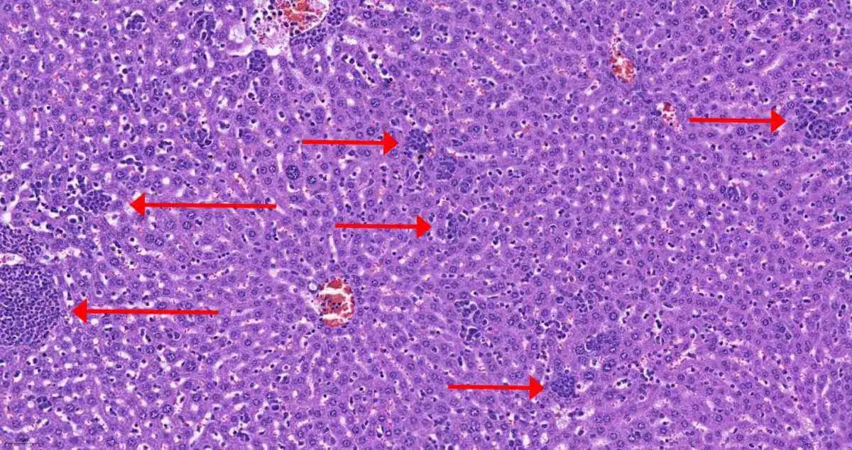 Why do cancer patients lose weight? the scientist Hayadan