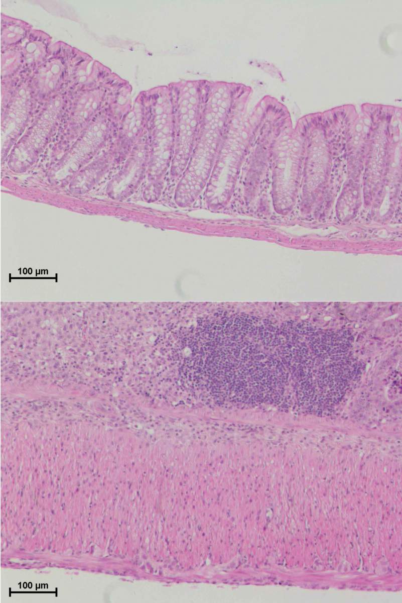 12 days after mucosal injury, severe inflammation can be observed in the colon tissue of a mouse without the NLRP10 inflammasome (bottom) and much greater damage to the tissue compared to the control mouse (top)
