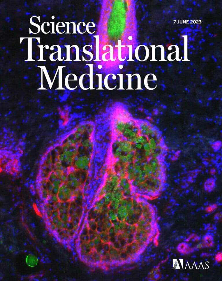 A new study by Prof. Ofra Bani from the School of Pharmacy at the Hebrew University of Jerusalem and Dr. Sharon Marims - dermatology specialist and senior physician at the dermato-oncology clinic at the Hadassah Medical Center and the Hadassah Cancer Research Institute, published in Science Translational Medicine courtesy of the Hebrew University