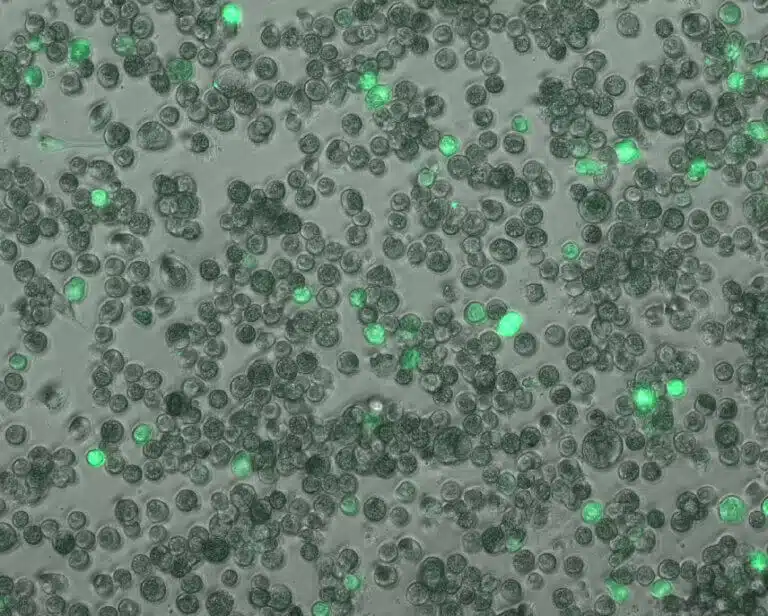 بلاعم الرئة المصابة بالفيروس المضخم للخلايا البشرية. باللون الأخضر الفاتح - الخلايا التي توجد بها عدوى نشطة