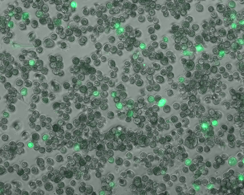 Lung macrophages infected with human cytomegalovirus. In bright green - the cells where there is an active infection