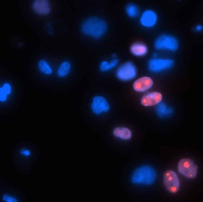 The replication centers of the human cytomegalovirus (in red) inside infected macrophage cells (in blue - the cell nuclei)