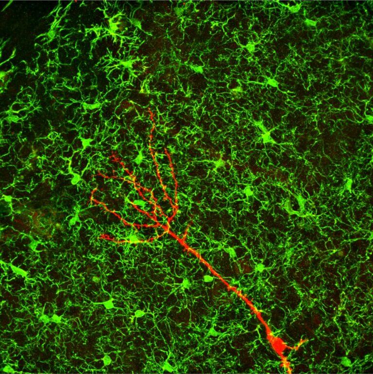 Microglial cells (in green) in the hippocampus region of the brain of an adult mouse, forming contact points with a new neuron (in red)