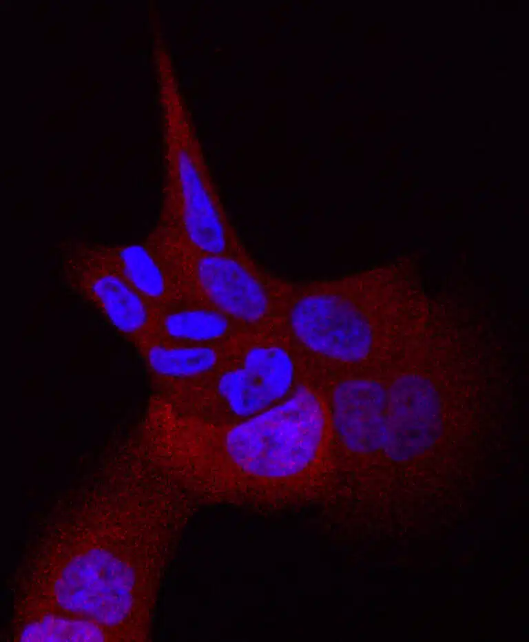תאי סרטן ריאות אנושיים עם המוטציה L858R בגן EGFR. בכחול – גרעיני התאים. באדום – חלבון המופיע בנוזל התא כאשר קולטני EGFR פעילים ודוחפים את התא לחלוקה בלתי-מבוקרת. באדיבות מכון ויצמן
