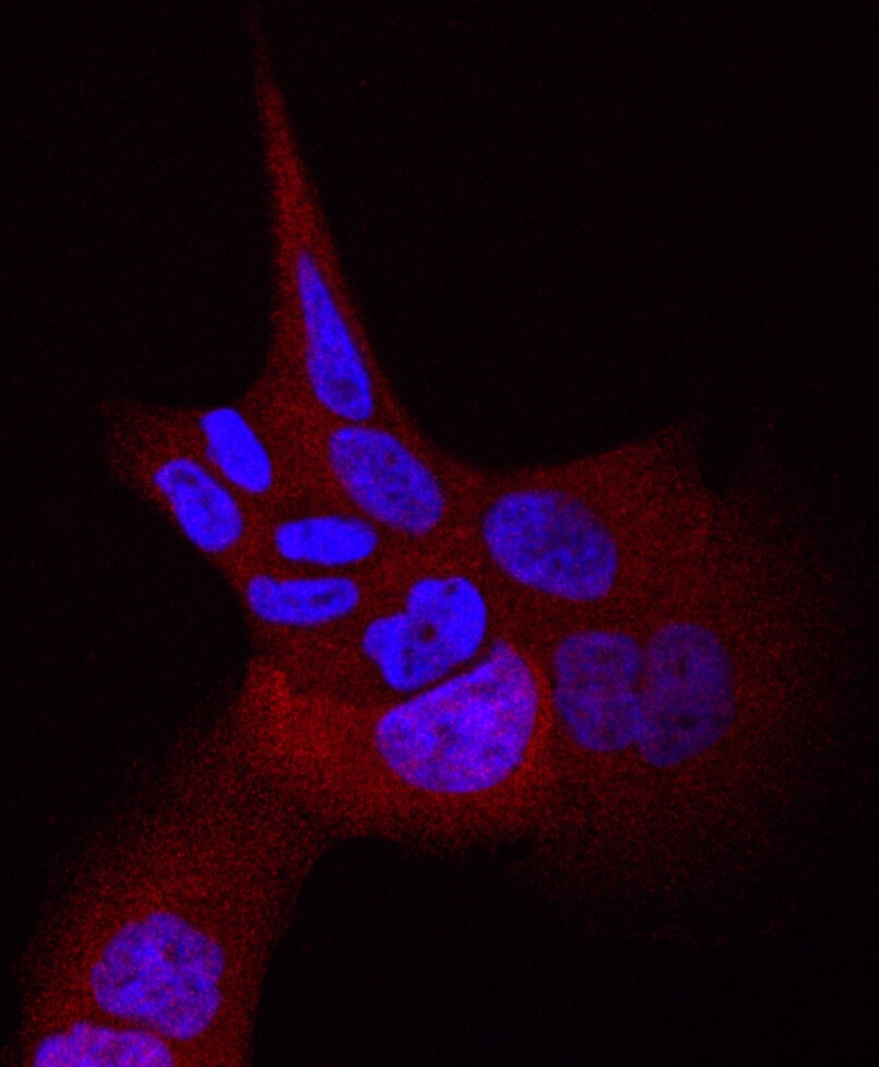 תאי סרטן ריאות אנושיים עם המוטציה L858R בגן EGFR. בכחול – גרעיני התאים. באדום – חלבון המופיע בנוזל התא כאשר קולטני EGFR פעילים ודוחפים את התא לחלוקה בלתי-מבוקרת. באדיבות מכון ויצמן

