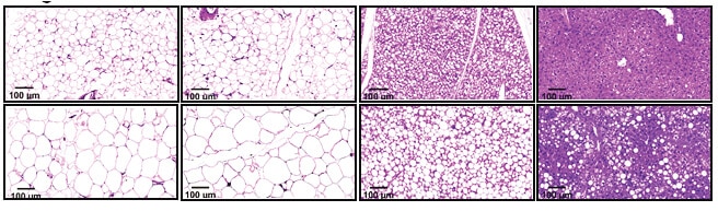 דגימות רקמה של עכבר בריא (שורה עליונה) ועכבר ללא הגן SARAF (שורה תחתונה): בעכברים ללא הגן נרשמה בהתאמה (משמאל לימין) עלייה בשומן במפשעות וסביב האיברים הפנימיים, ירידה בשומן החום והופעה של כבד שומני