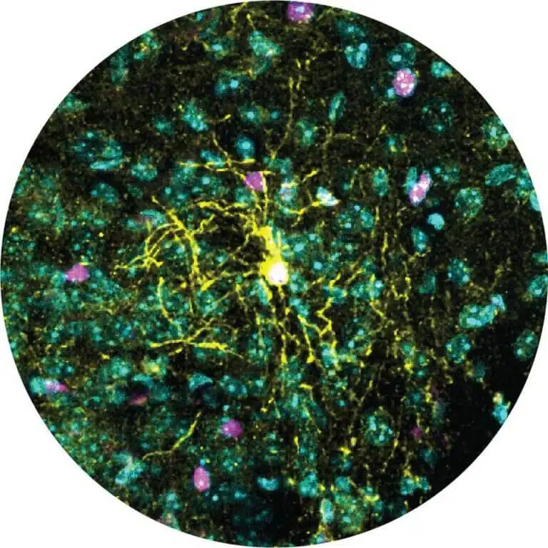 خلية من نوع الخلايا قليلة التغصن تحتوي على العديد من فروعها (باللون الأصفر) في قسم من دماغ الفأر. يتفاعل مع التوتر بشكل مختلف تمامًا عند الذكور والإناث