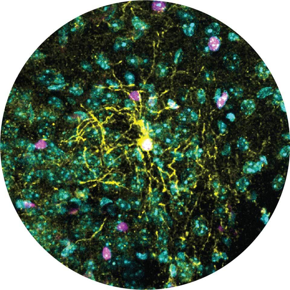An oligodendrocyte-type cell with many of its branches (in yellow) in a mouse brain section. Reacts to stress quite differently in males and females