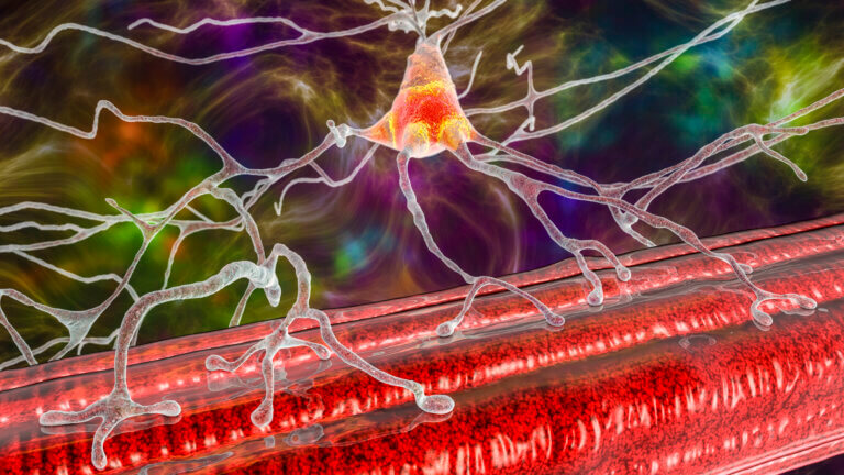 Damage to the motor nerves in Duchenne patients. Illustration: depositphotos.com