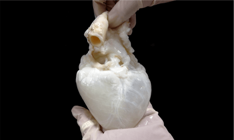 A "ghost" heart is a pig heart that has been prepared so that it can be transplanted into humans. Provided by Doris Taylor