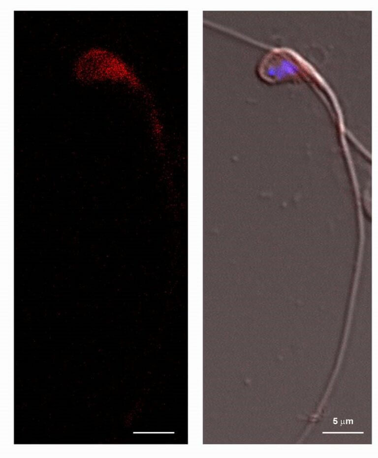 On the right: sperm cell of a healthy mouse. On the left: the product (protein) of the SCAPER gene (colored in red). The photograph shows that SCAPER is located at the head of the sperm cell, including in the nucleus