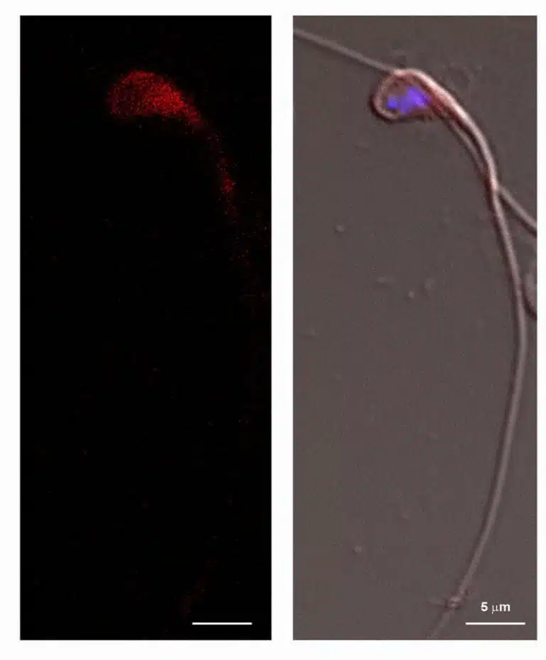 מימין: תא זרע של עכבר בריא משמאל: תוצר (חלבון) הגן SCAPER (צבוע באדום). הצילום מראה ש-SCAPER ממוקם בראשו של תא הזרע, כולל בגרעין