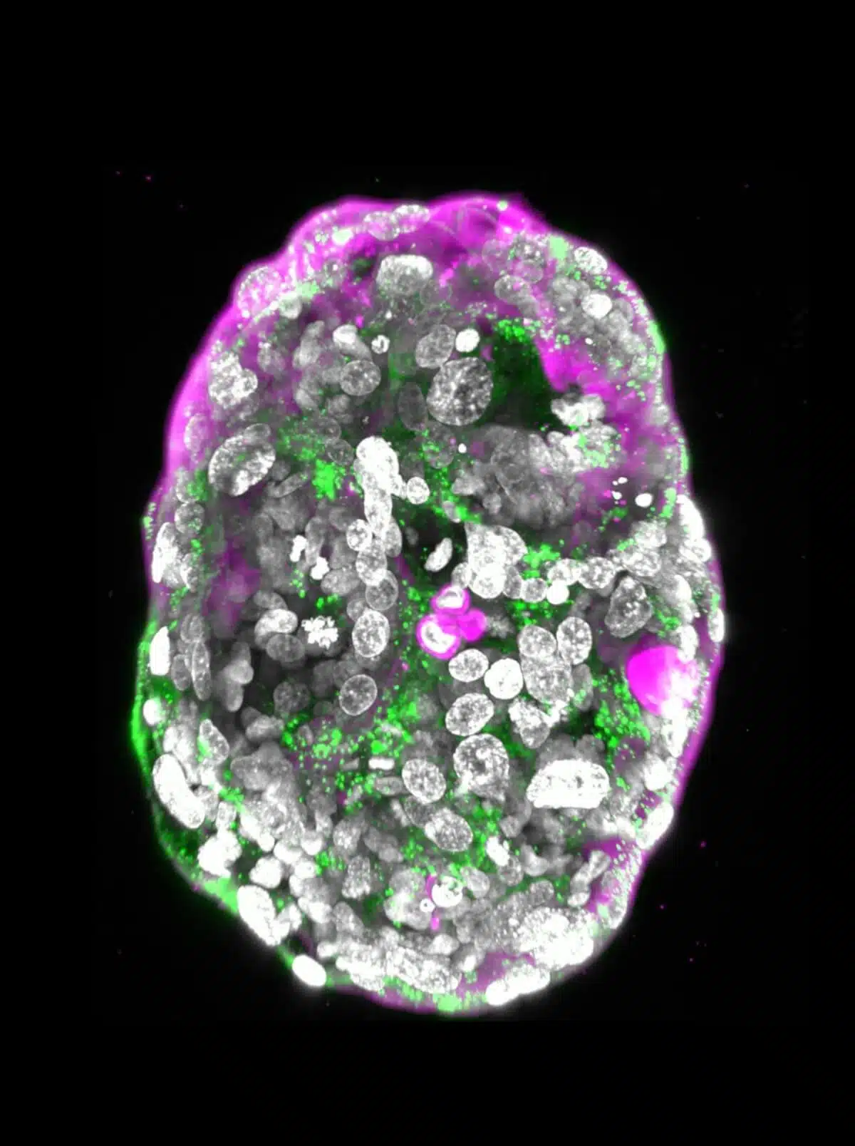 Microscope image of the embryonic model at a developmental stage corresponding to day 14. The outer layer which will become the placenta (pink), contains spaces called "lacuns". In a normal pregnancy, the lacunae allow the passage of nutrients from the mother's circulation. In green - the molecules of the hormone used in pregnancy tests