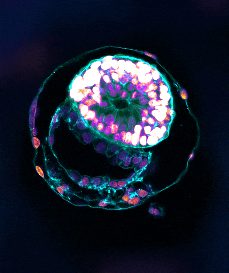 An artificial model of a human embryo in a developmental stage corresponding to day 12. The upper elliptical structure is the part that will become an embryo including the amniotic sac above it; The lower structure is the yolk sac. The interface between the two structures is an essential element for embryonic development in humans. Both parts are surrounded by a layer of cells which will become the placenta