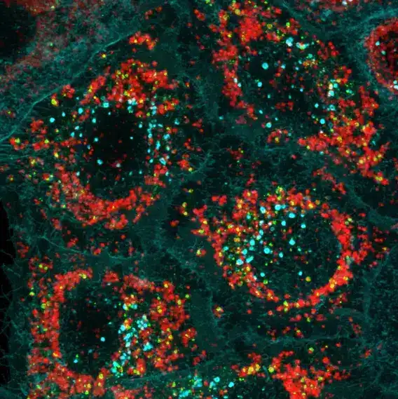 Cellular "garbage bags" are built using optineurin (in green) around damaged mitochondria (in red). Credit: WEHI