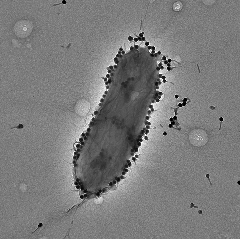 A specific and particularly successful phage named PASA16 discovered by the Israeli center treated 16 patients, most of them severe, and it demonstrates the high potential effectiveness of treatment in dealing with challenging and antibiotic-resistant Pseudomonas aeruginosa infections. Photography: Ronen Hazan