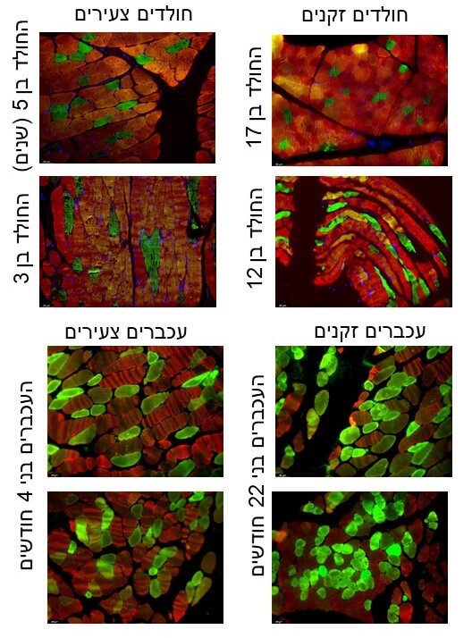 סיבי שריר מהירים/ “אתלטיים” (מסומנים באדום) וסיבי שריר איטיים(מסומנים בירוק) בחולדים ועכברים