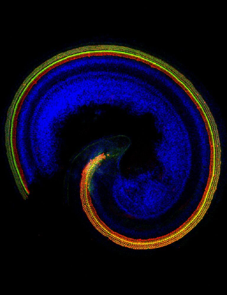 Immunofluorescence of the mouse inner ear. The spiral structure of the inner ear consists of hair cells and supporting cells, which together allow us to hear. Each cell type is shown in a different color. Image: Dr. Shahar Tiber