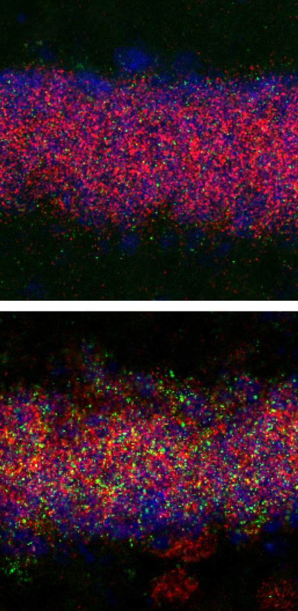 Neurons in the hippocampus of adult mice exposed to trauma at an early age (bottom) responded differently to bullying than those cells in mice that were not exposed to trauma at an early age (top). One of the most striking differences (in green) is registered in the excitatory neurons of the glutamate system (in red)