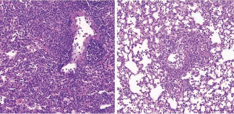 רקמת ריאה בעכבר סוכרתי (מימין) מכילה פחות תאים של המערכת החיסונית (נקודות סגולות) מאשר רקמה זו בעכבר לא-סוכרתי (משמאל)
