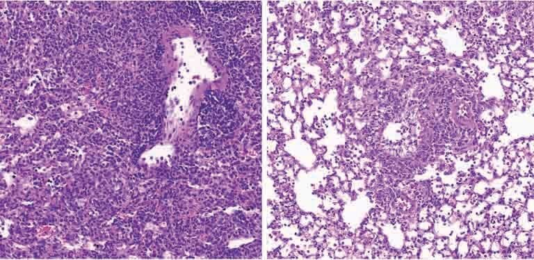 Lung tissue in a diabetic mouse (right) contains fewer immune system cells (purple dots) than this tissue in a non-diabetic mouse (left)