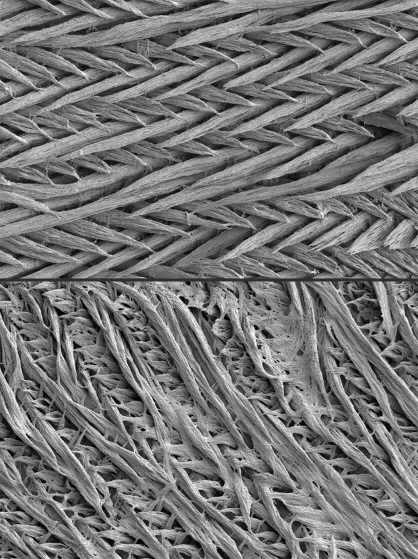 תמונות מיקרוסקופ אלקטרונים של שכבת האמייל העוטפת שיני עכבר. למעלה: מבנה אמייל תקין, למטה: התפתחות אמייל פגומה בעקבות תקיפה של נוגדנים עצמיים לחלבוני האמייל
