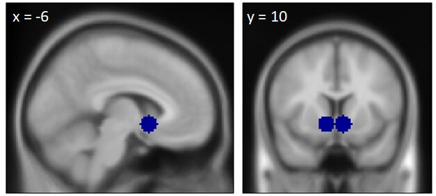 The brain area associated with reward (the ventral striatum) where increased activity was found when the stereotype was fulfilled