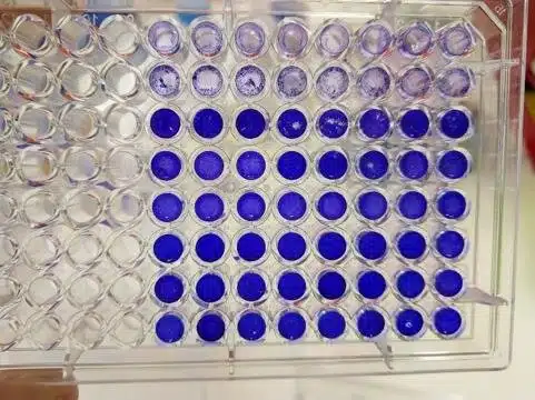 תאים שהחוקרים הדביקו בקורונה (צבע חלש יותר מעיד שנהרסו עקב ההדבקה)