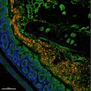 השמר החדש התגלה לראשונה במקרה במעי עכבר (תמונת מיקרוסקופ פלואורסצנטי של רקמת מעי, באדום – תאי השמר על-שם ויצמן)