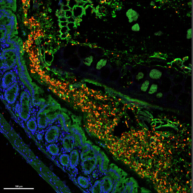 השמר החדש התגלה לראשונה במקרה במעי עכבר (תמונת מיקרוסקופ פלואורסצנטי של רקמת מעי, באדום – תאי השמר על-שם ויצמן)