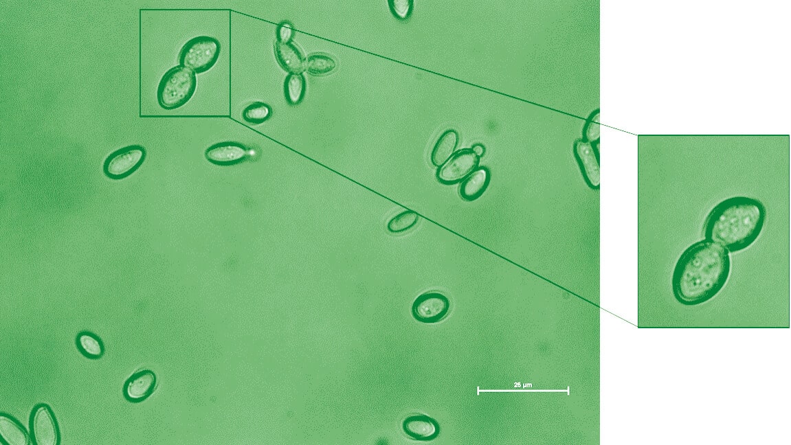 מונת מיקרוסקופ אור של תאי Kazachstania weizmannii – מין השמר שהתגלה במחקר