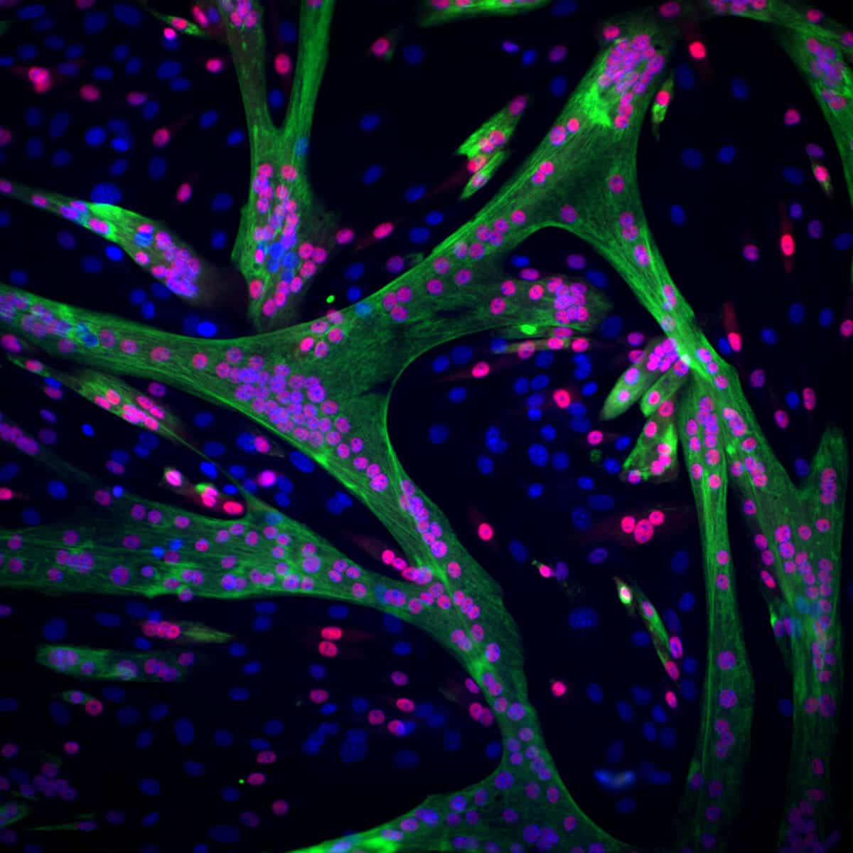 Muscle in the making: stem cells of muscle tissue (their nuclei are marked in blue) gradually change their structure and function and become mature muscle cells (the cells whose nuclei have turned red). These cells will eventually fuse into one long, multinucleated muscle cell. The ability of this muscle to contract is thanks to a large number of protein fibers produced in the mature muscle cells (marked in green)