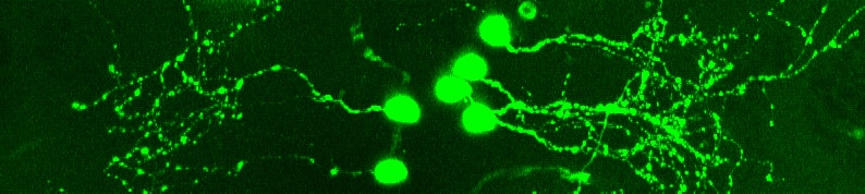 صورة مضان لستة خلايا عصبية منتجة للسيروتونين في دماغ سمكة الزرد