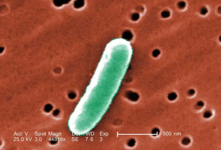 אַנַבֵּינָה תחת המיקרוסקופ. החיידקים הכחוליים שימשו השראה למחקר