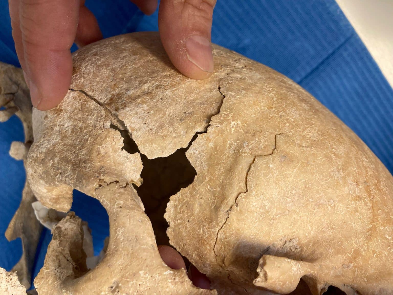 מחקר של נזירים לוחמים מימי הביניים בטירת זוריטה דה לוס קאנס חשף את התזונה היוקרתית שלהם ואת מותם האלים, כולל תגלית בלתי צפויה של לוחמת ביניהם, מה שמרחיב את הבנתנו לגבי תפקידי מגדר במסדרים צבאיים היסטוריים. גולגולת שנמצאה באתר הארכיאולוגי של זוריטה דה לוס קאנס. קרדיט: קרמה ריסק, URV