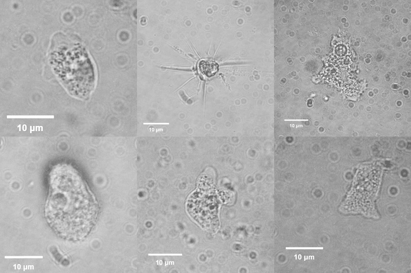 صور مجهرية للأميبا وجدت في ينابيع منطقة طبريا. تصوير: د. شيرا نينو و د. عوديد بيرجمان