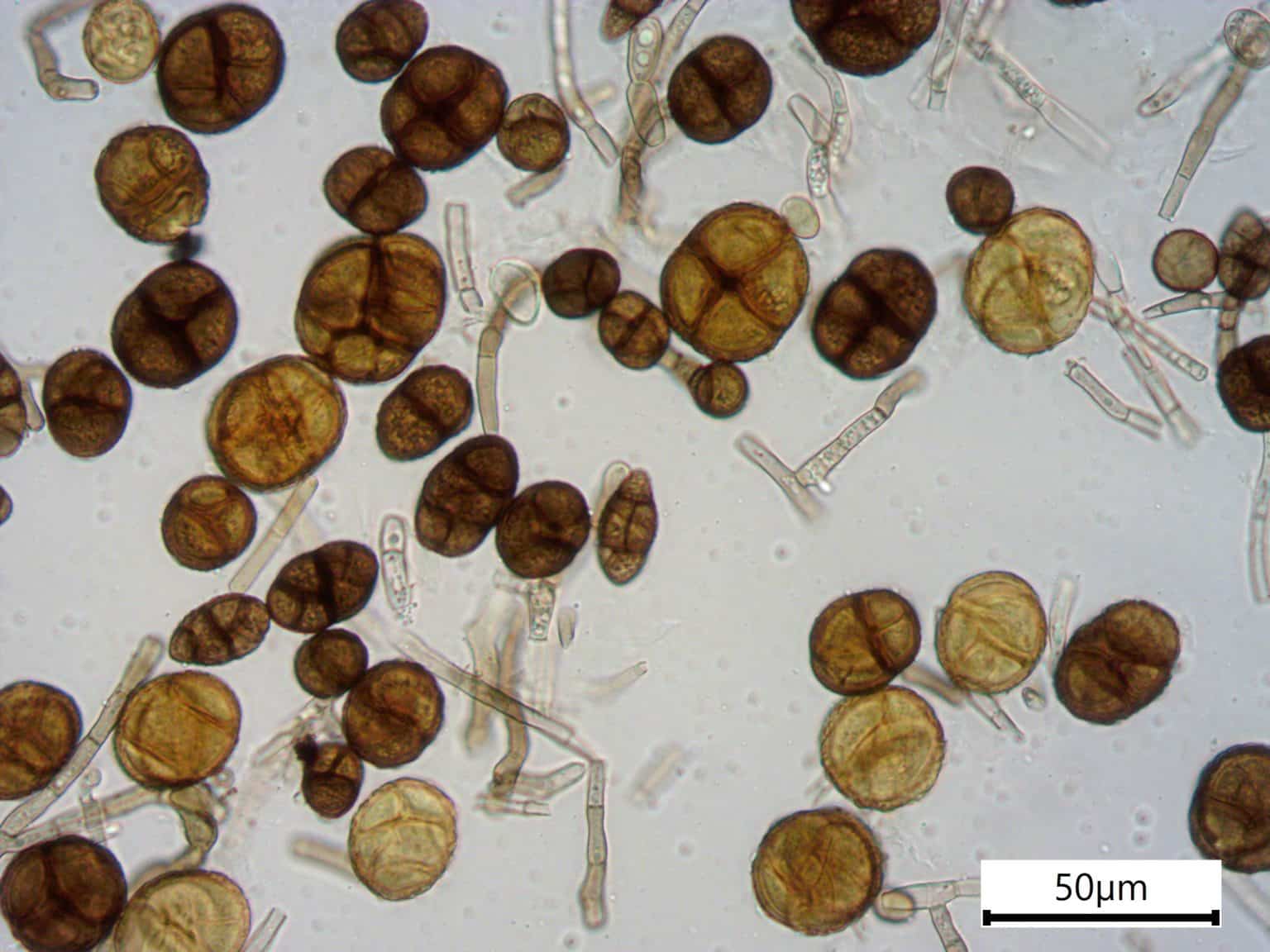 תרבית פטרייה: קונידיות של Alternaria sp. NS1. קרדיט: לאורה רבאכין, INTK, האקדמיה לאמנות, וינה