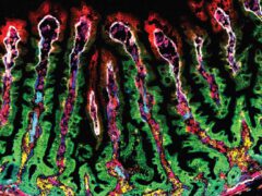 تصوير أنسجة الأمعاء الدقيقة البشرية باستخدام طريقة تلطيخ مضان تسمح بوضع علامات على عدد كبير من البروتينات في نفس الوقت وبالتالي تحديد البروتينات التي يتم إنتاجها في المنطقة القاعدية بأكملها من الأمعاء