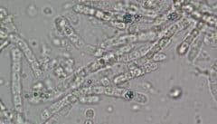 هكذا يبدو تحت المجهر الضوئي: تخزين الموليبدينوم في بكتيريا Entotheonella، ويمكن رؤيته في اللون الأزرق bucoelos (الصورة: شاني شوهام)