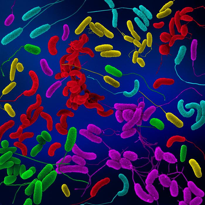 מגוון מיני Vibrio פתוגניים, כולל Vibrio vulnificus (כחול), Vibrio cholerae (אדום), Vibrio fluvialis (סגול), Vibrio alginolyticus (צהוב) ו-Vibrio parahaemolyticus (ירוק).