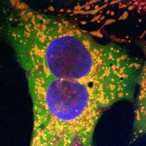 خلايا بشرية خضعت للتعديل الجيني باستخدام تقنية تعديل جينات جديدة قائمة على الريترون. تشير النقاط البرتقالية إلى نجاح عمليات التعديل الجيني. تُظهر النقاط الخضراء علامة بروتينية فلورية على سطح الميتوكوندريا. حقوق الصورة: يو تشيون تشانغ / جامعة تكساس في أوستن.
